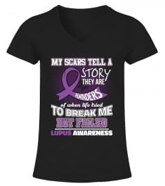 My Scars Tell a Story - Lupus Awareness